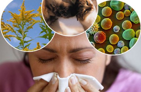 Аллергия причины возникновения